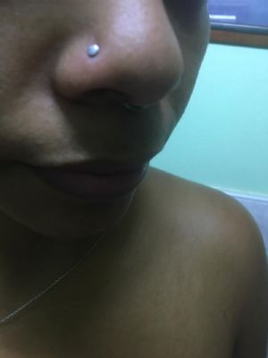 Internally Threaded Titanium Labret Post Customer Photo